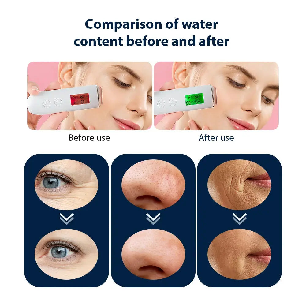 Oxygen Bubble Pen | 7 Led Colors | Portable Skin Rejuvenator