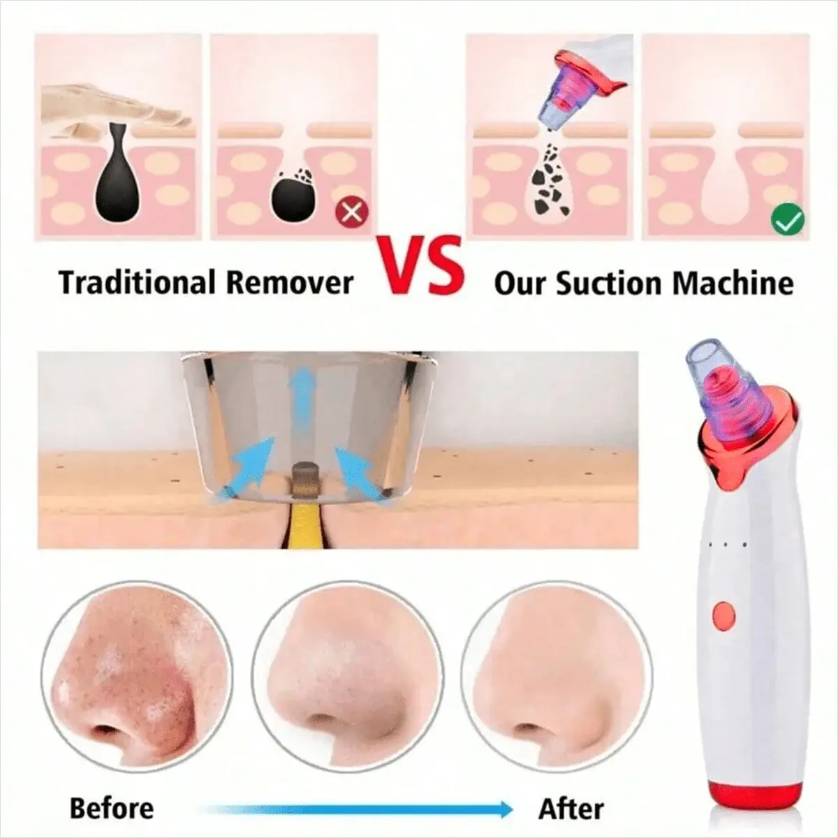 2026 Blackhead Remover Pimple Acne Removal Blackhead Vacuum Tool Skin Care Pore Cleaner Rechargeable from PriceLows™