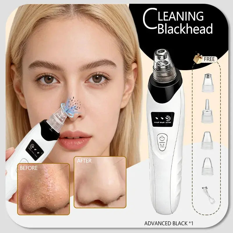 Professional Blackhead Vacuum - Rechargeable Pore Extractor for Blackheads, Oily Skin & Facial Cleansing from PriceLows™