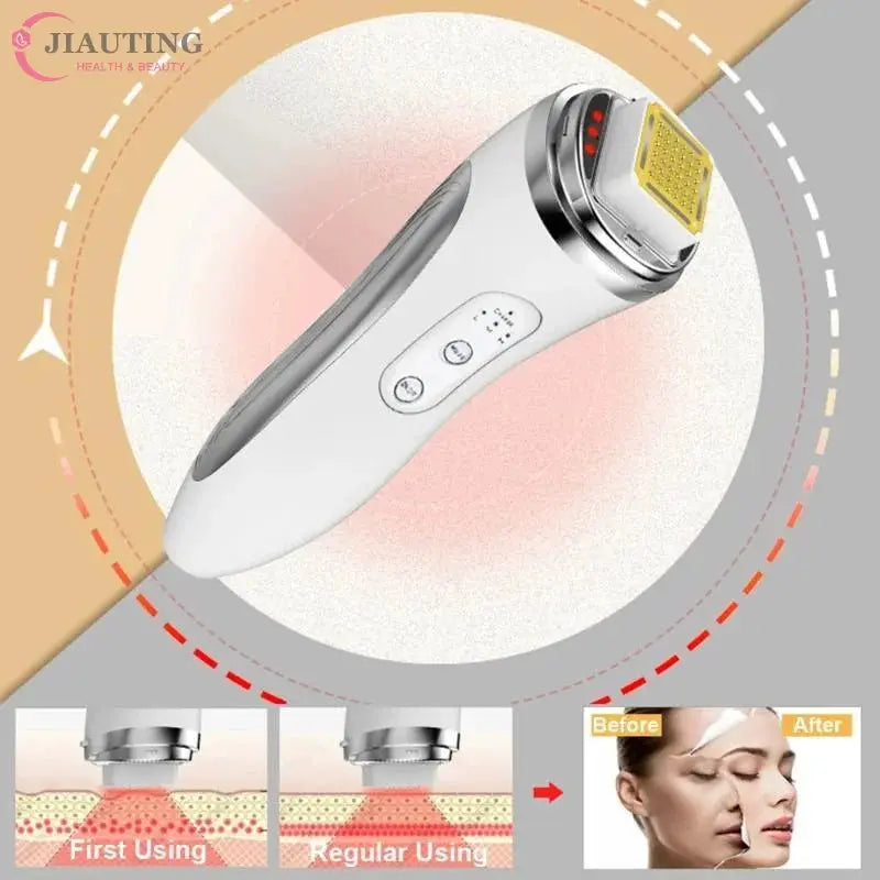 RF Skin Tightening Device | Dot Matrix | Anti Wrinkle | Portable