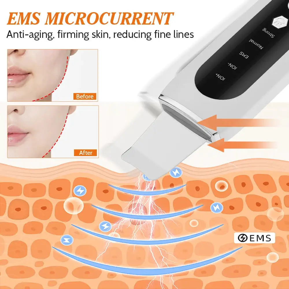2 Types Ultrasonic Skin Scrubber Peeling Shovel Acne Blackhead Remover Deep Cleaning Facial Spatula EMS Face Lifting Machine from PriceLows™