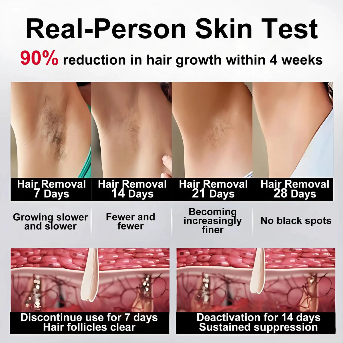 Ipl Hair Removal Device | 1200Nm Wavelength PriceLows