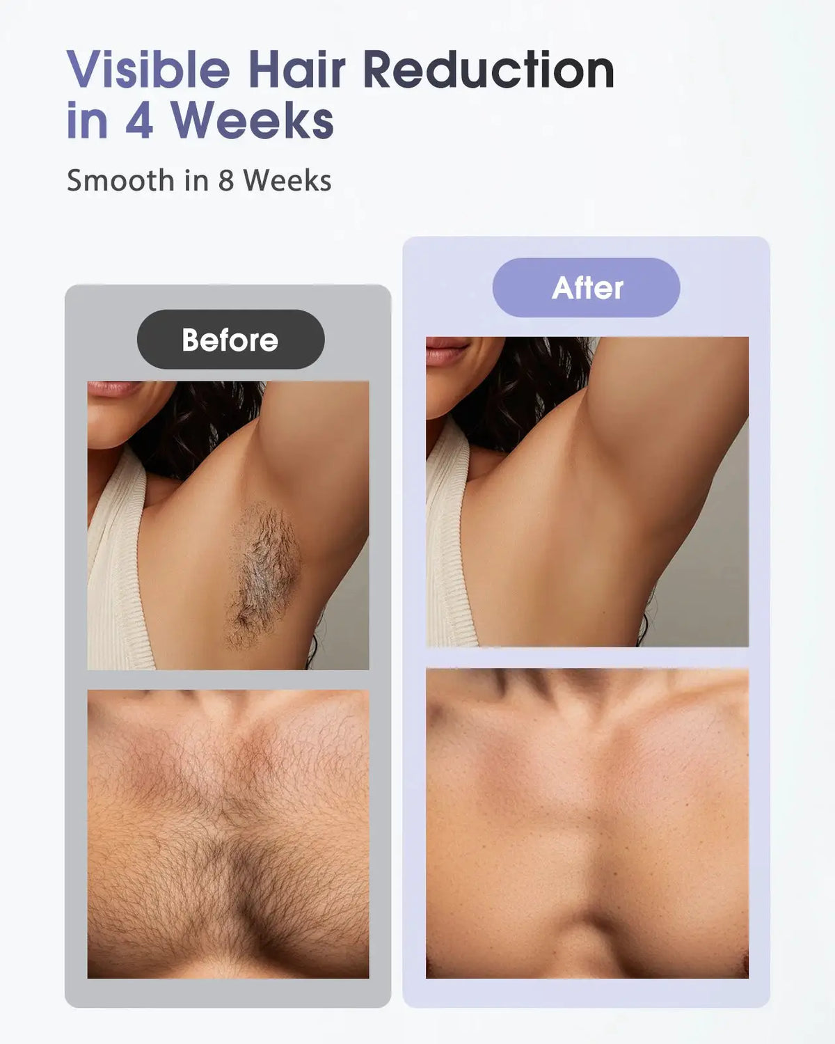 Ipl Hair Removal Device | 90 Min Battery | PriceLows™