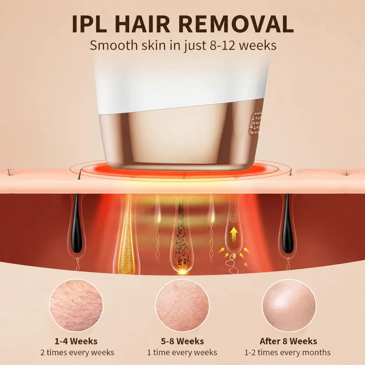 Lysmoski Ipl Hair Removal Device | 999900 Flashes | PriceLows™