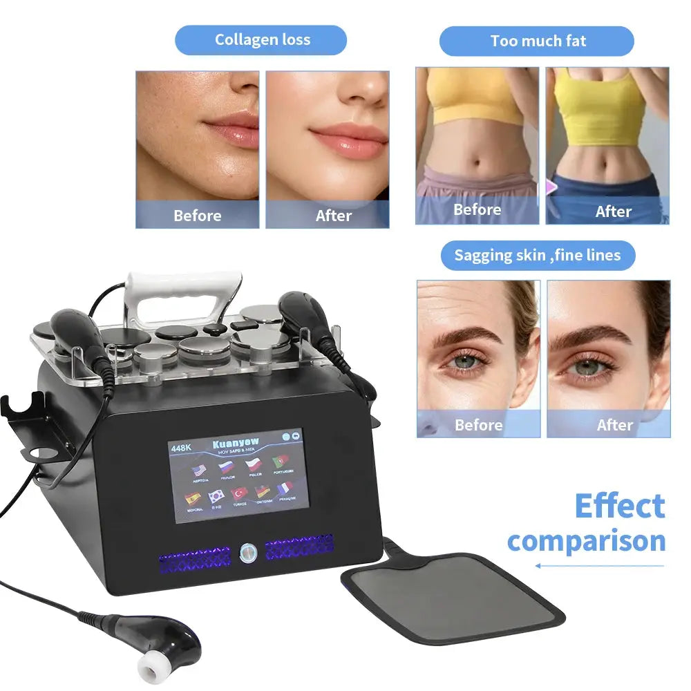 Manual Body Massager | Thermo Roller | PriceLows™