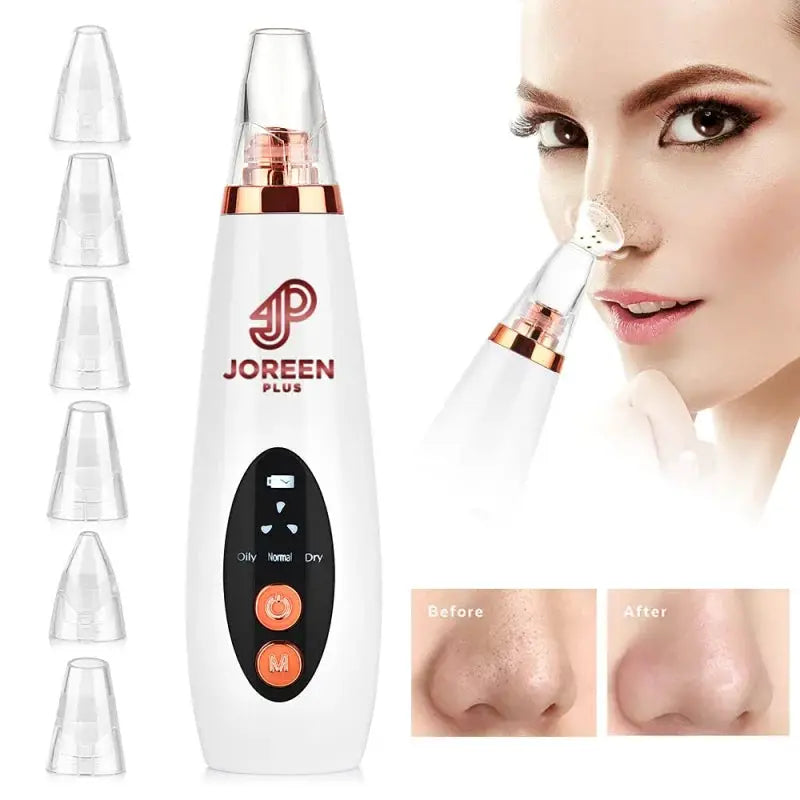 Blackhead Remover Pore Vacuum - JOREEN PLUS (Update)Electric Blackhead Remover Tool Acne Extractor Facial Cleansing Tool Kit,Sui from PriceLows™