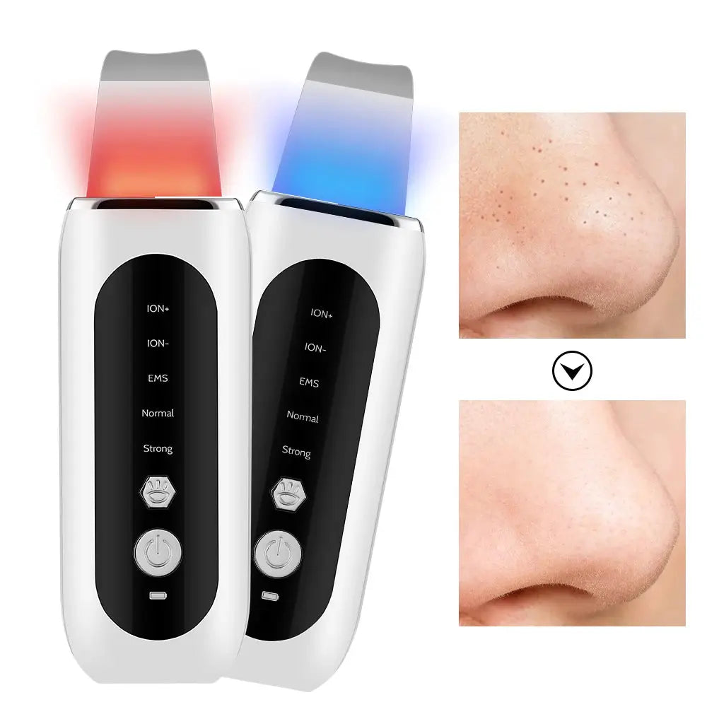 2 Types Ultrasonic Skin Scrubber Peeling Shovel Acne Blackhead Remover Deep Cleaning Facial Spatula EMS Face Lifting Machine from PriceLows™