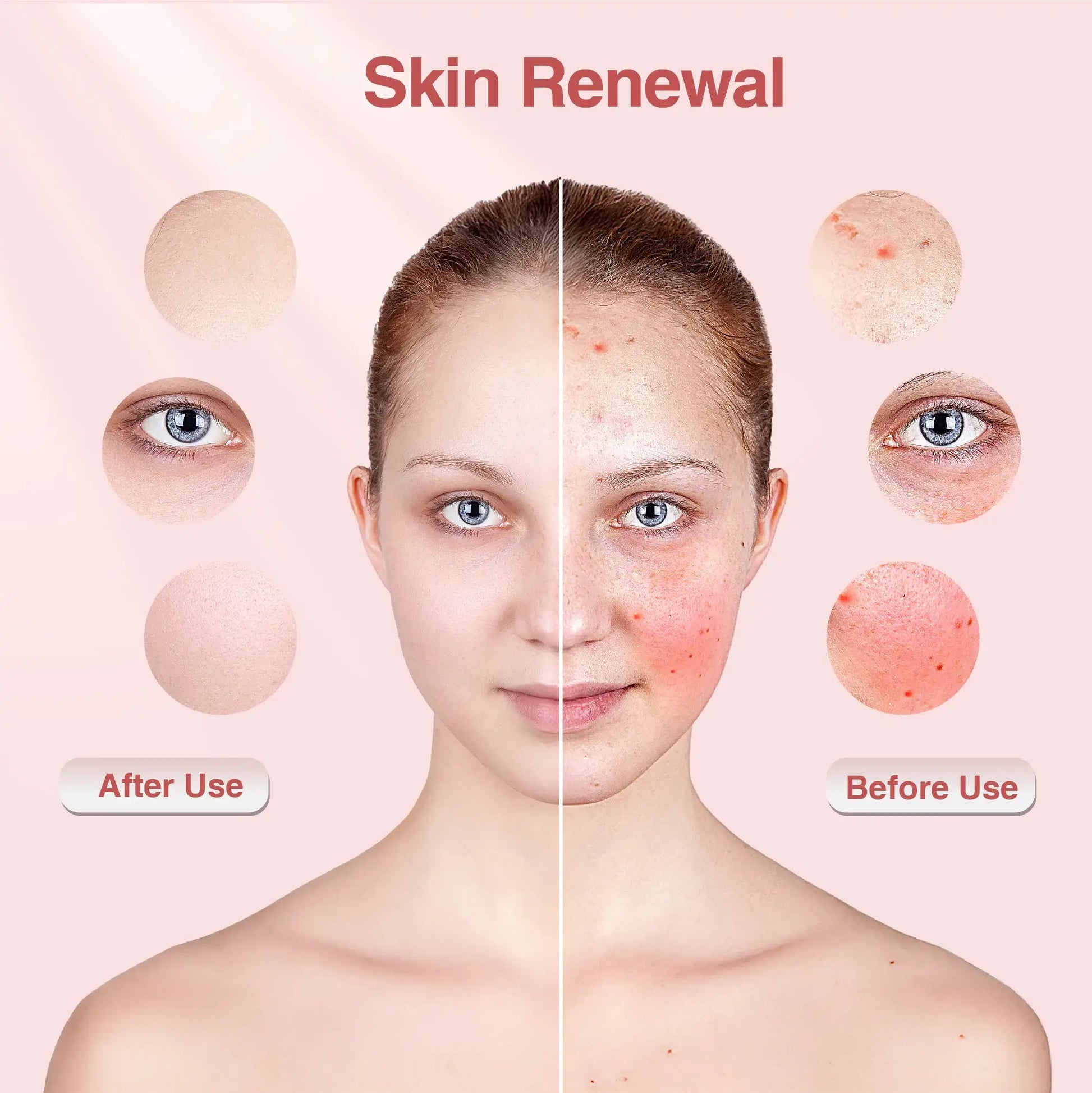 Hello Face M500S Ultra-light LED Red Light Therapy Photon Mask Near-Infrared Light Therapy Facial Mask Professional Face Care from PriceLows™