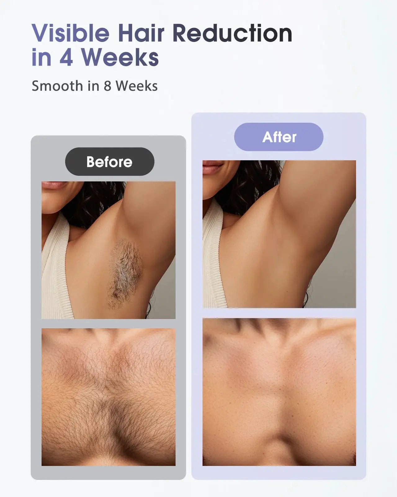 Ipl Hair Removal Device | 90 Minute Battery | Ice Cooling Nozzle | Face And Body