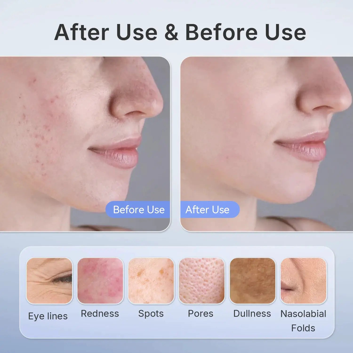 Hello Face 510K Wireless Near-Infrared and Red Light Therapy Facial Mask For Powerful Anti-ageing Professional Ultra-light Mask from PriceLows™