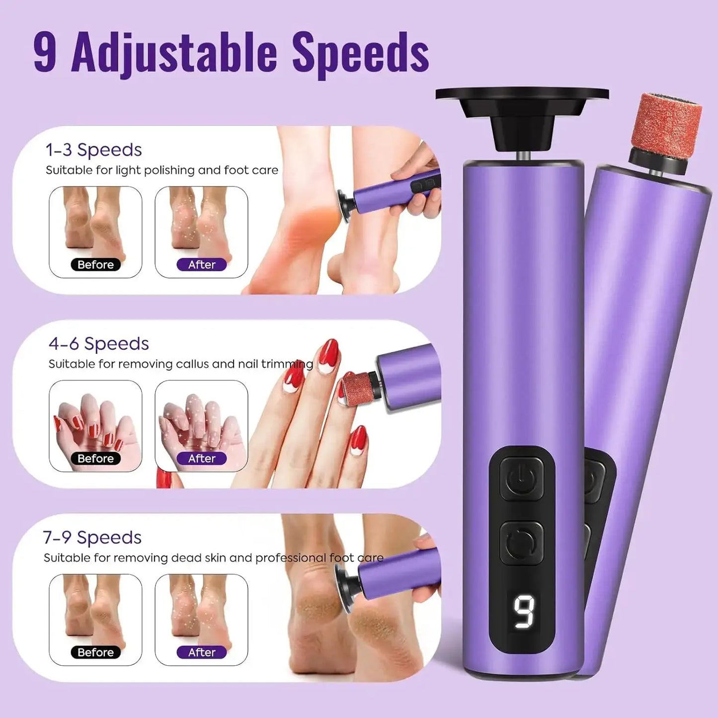 Electric Foot Callus Remover 2-in-1 Electric Foot File Grinder Nail Polisher 9-Speed Feet Pedicure Tool for Dead Skin & Cracked from PriceLows™