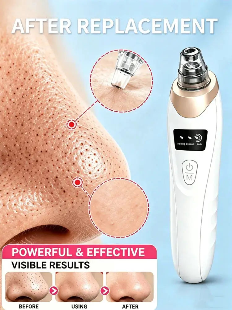 Professional Blackhead Vacuum - Rechargeable Pore Extractor for Blackheads, Oily Skin & Facial Cleansing from PriceLows™