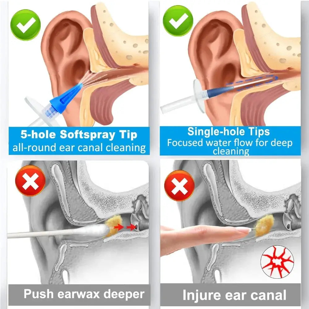 Ear Wax Removal Tool Manual Ear Irrigation Flushing System Safe and Effective Ear Cleaner for Adults Kids Cleaning Washer Kit from PriceLows™