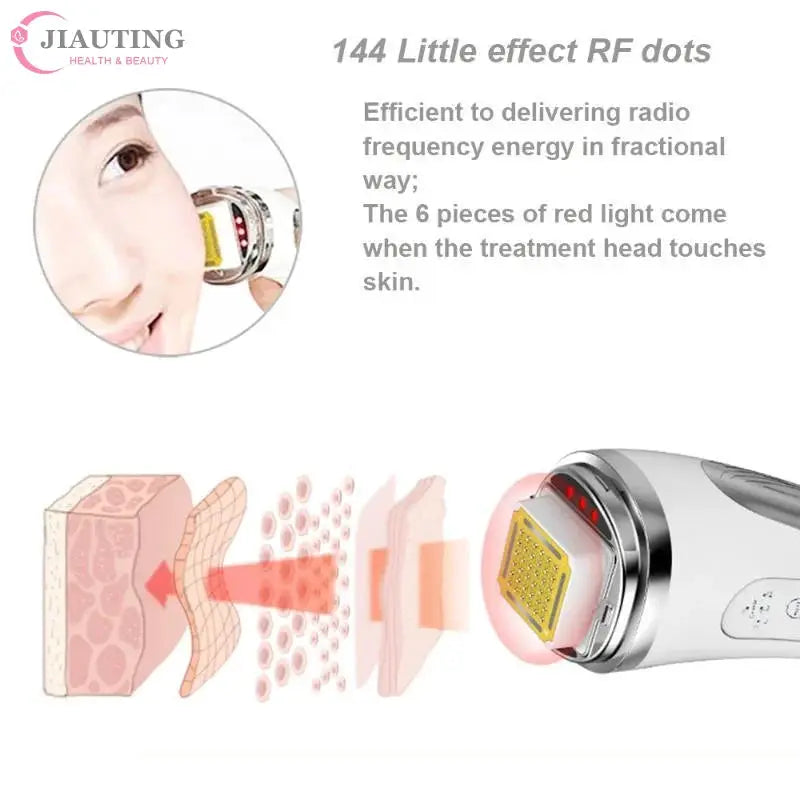 RF Skin Tightening Device | Dot Matrix | Anti Wrinkle | Portable