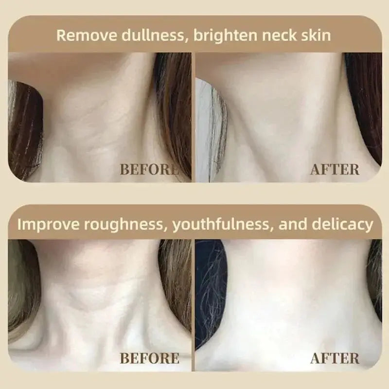 2025 Neck LED Lift Mask Photon Anti-Wrinkle Skin Tightening Neck Beauty Device Skin Brighten Rejuvenation Neck Wrinkle Remover from PriceLows™
