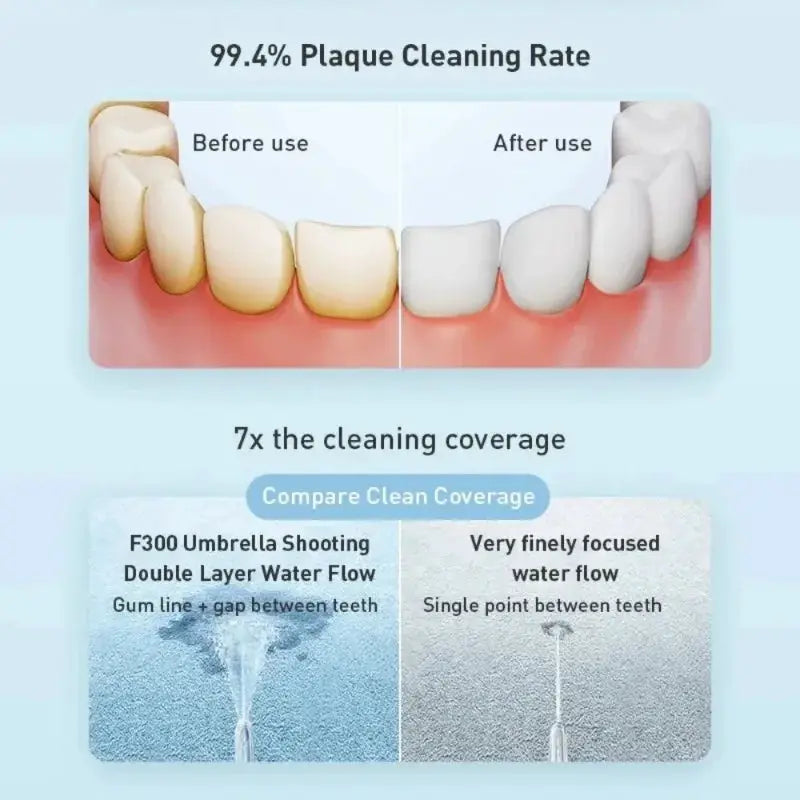 Oral Irrigator | F300 Water Flosser | Teeth Whitening | Portable