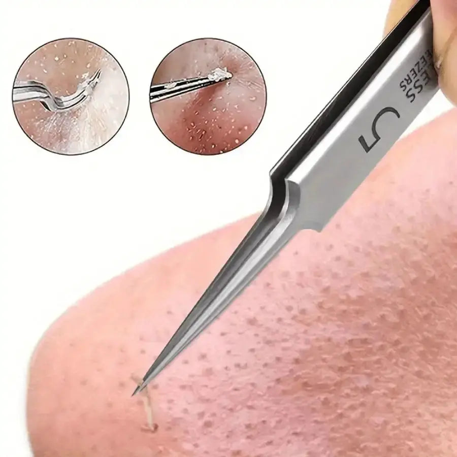 Fine Needle Tweezers | Stainless Steel | Blackhead Acne Pore Remover