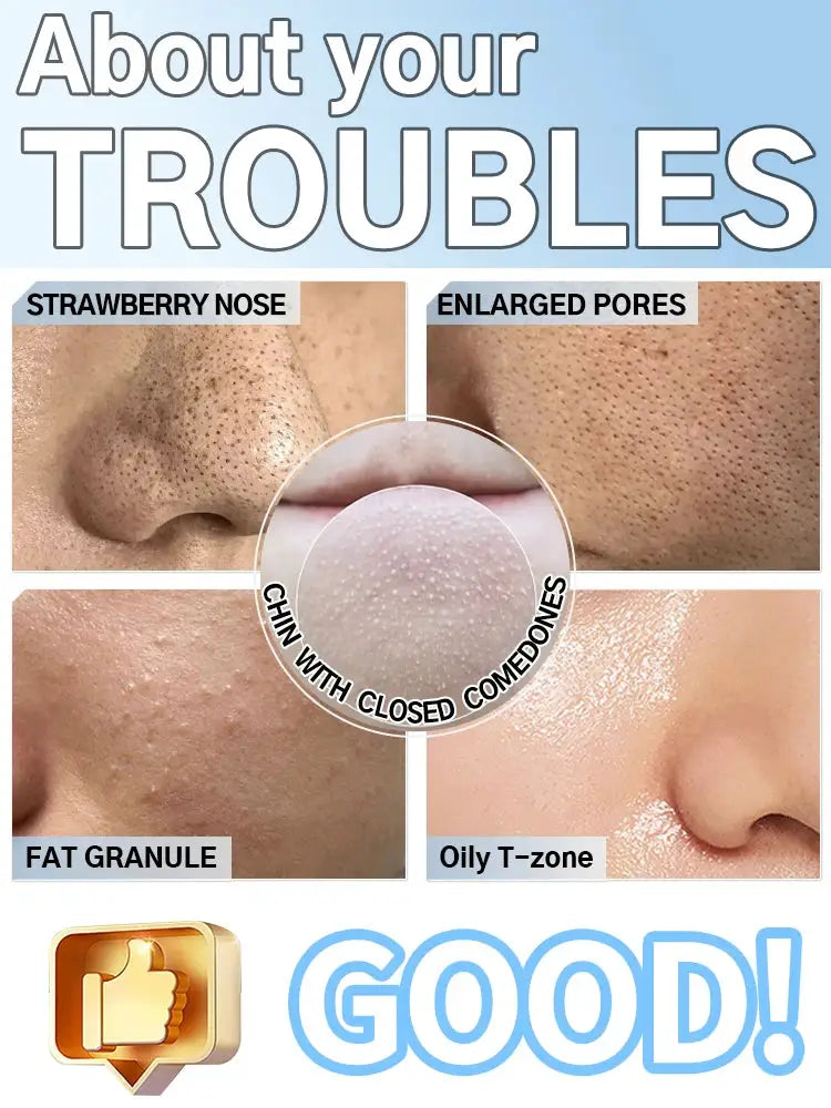 Professional Blackhead Vacuum - Rechargeable Pore Extractor for Blackheads, Oily Skin & Facial Cleansing from PriceLows™