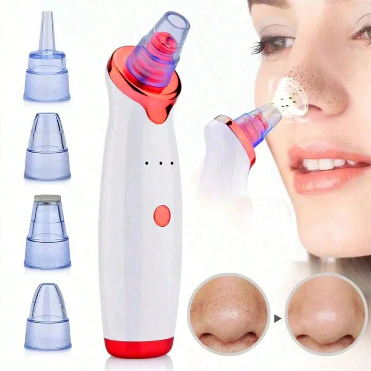 2026 Blackhead Remover Pimple Acne Removal Blackhead Vacuum Tool Skin Care Pore Cleaner Rechargeable from PriceLows™