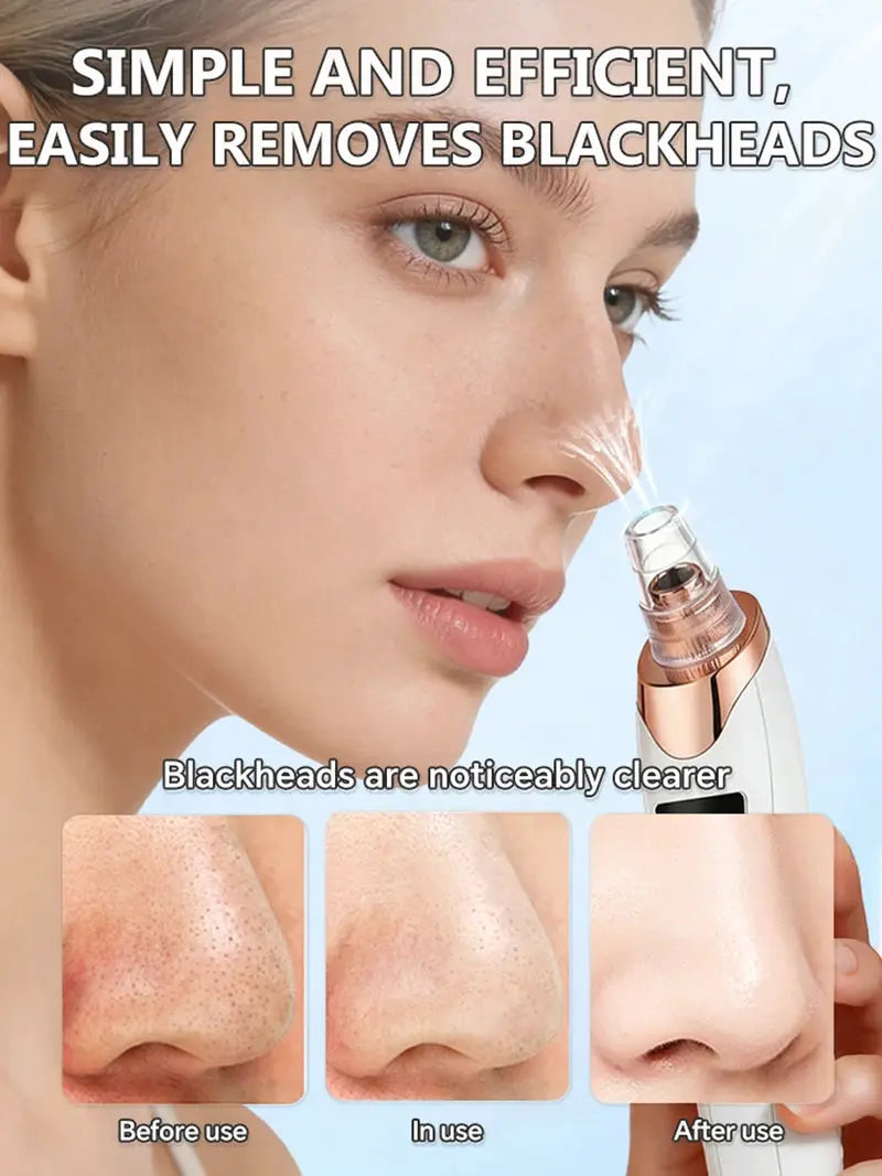 Blackhead Remover Pore Cleaner Black Dots Vacuum Cleaner Skin Pimple Acne Extractor Facial Cleaning Electric Black Head Removal from PriceLows™