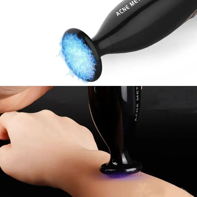 Plasma Pen | 5 Level Settings | USB Rechargeable | Face And Neck