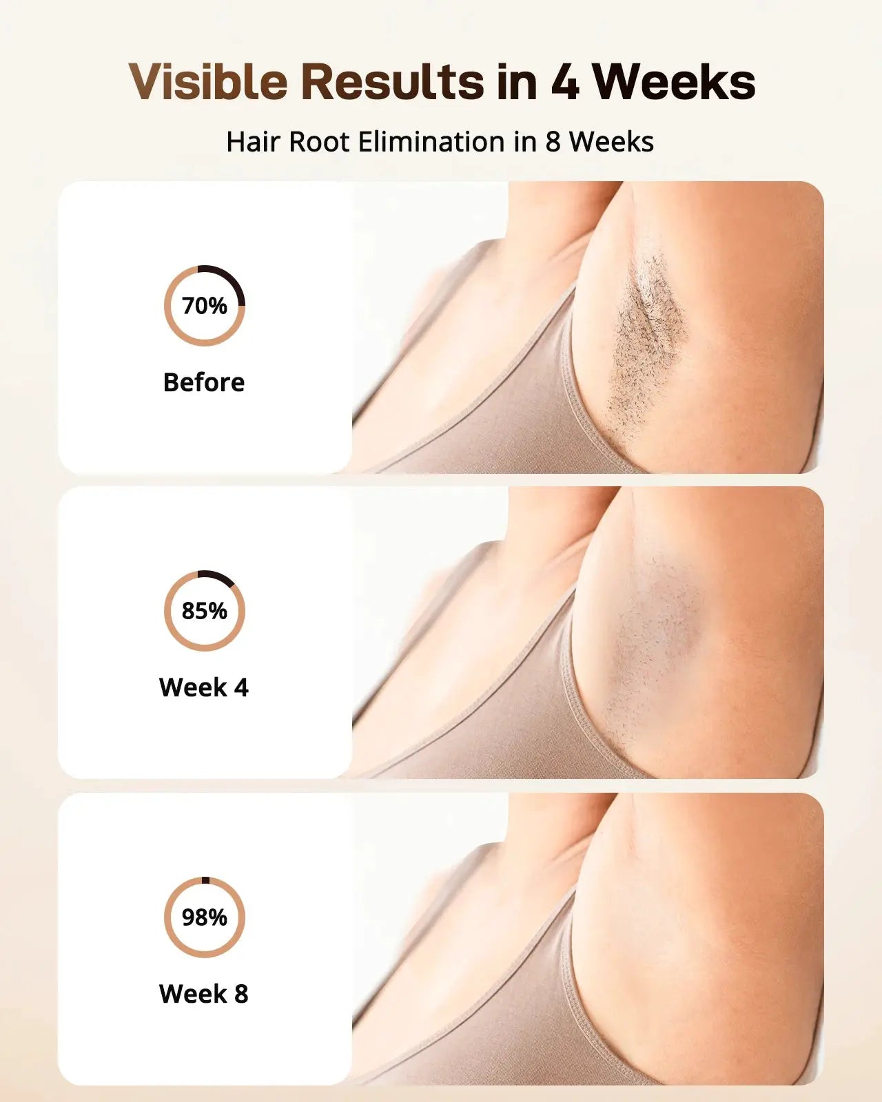 Ipl Hair Removal Device | Ice Cooling | 16J Power | For Men And Women
