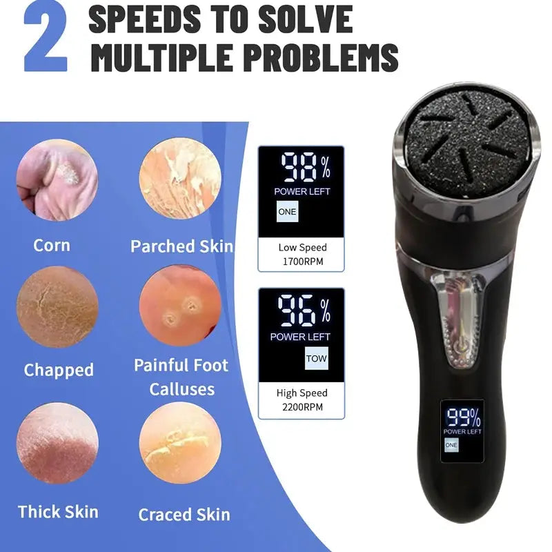 Rechargeable Electric Foot Rasp Electric Pedicure Foot Sander IPX7 Waterproof 3 Grinding Heads to Eliminate Feet Dead Skin from PriceLows™