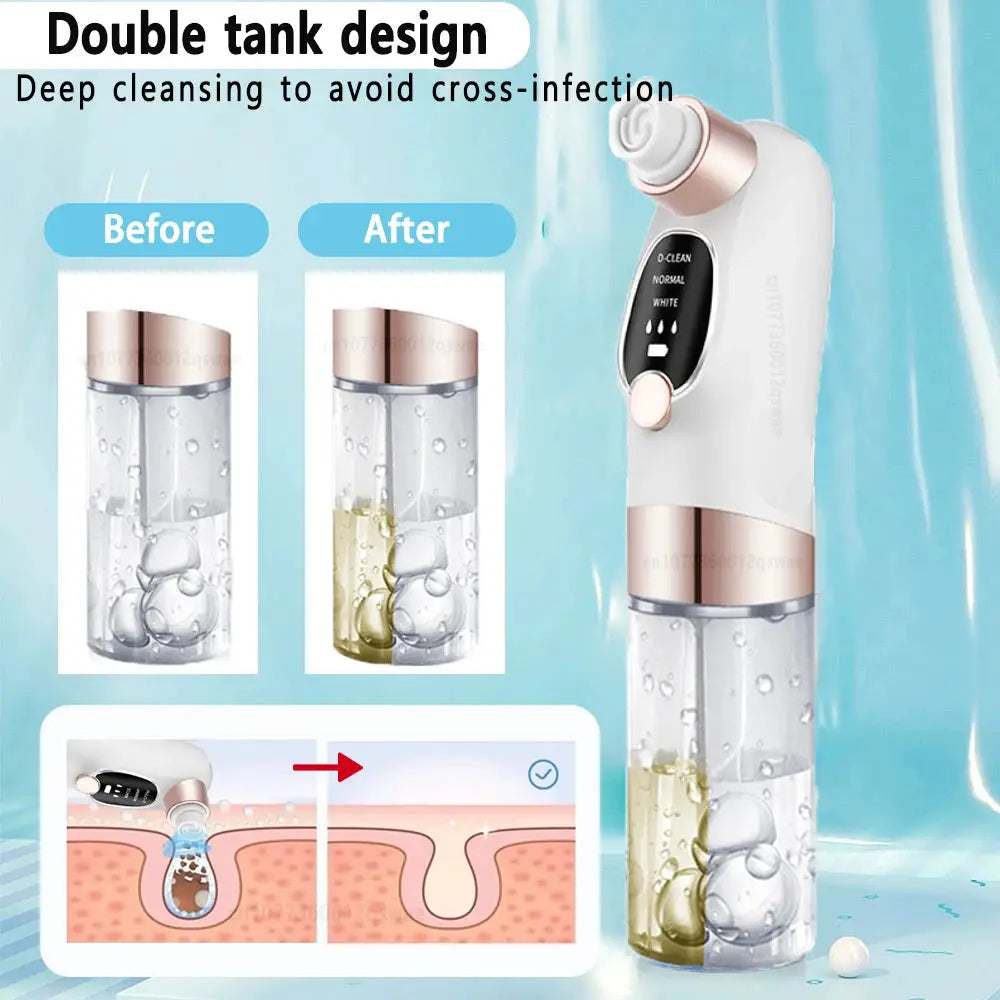 Blackhead Remover Pore Vacuum Face Cleaner Electric Pimple Acne Black Head Removal USB Rechargeable Water Cycle Black Dot Remove from PriceLows™