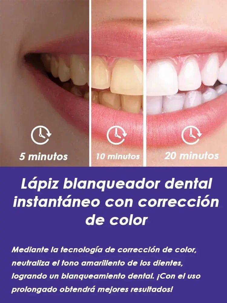 Teeth Whitening Pen | Instant Whitening | No Sensitivity | Removes Stains