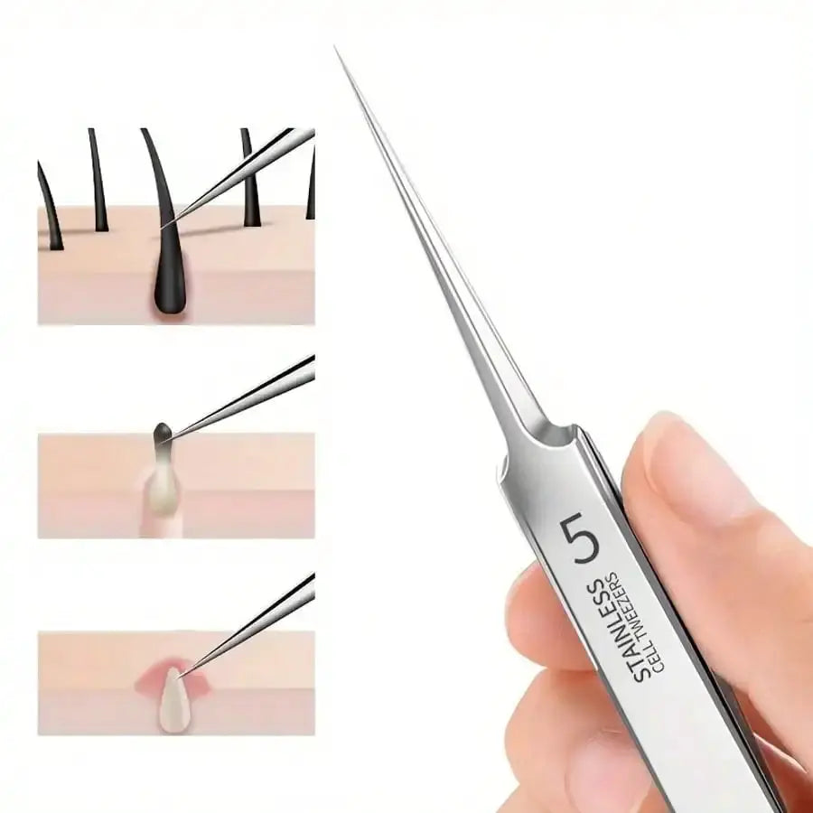 Fine Needle Tweezers | Stainless Steel | Blackhead Acne Pore Remover