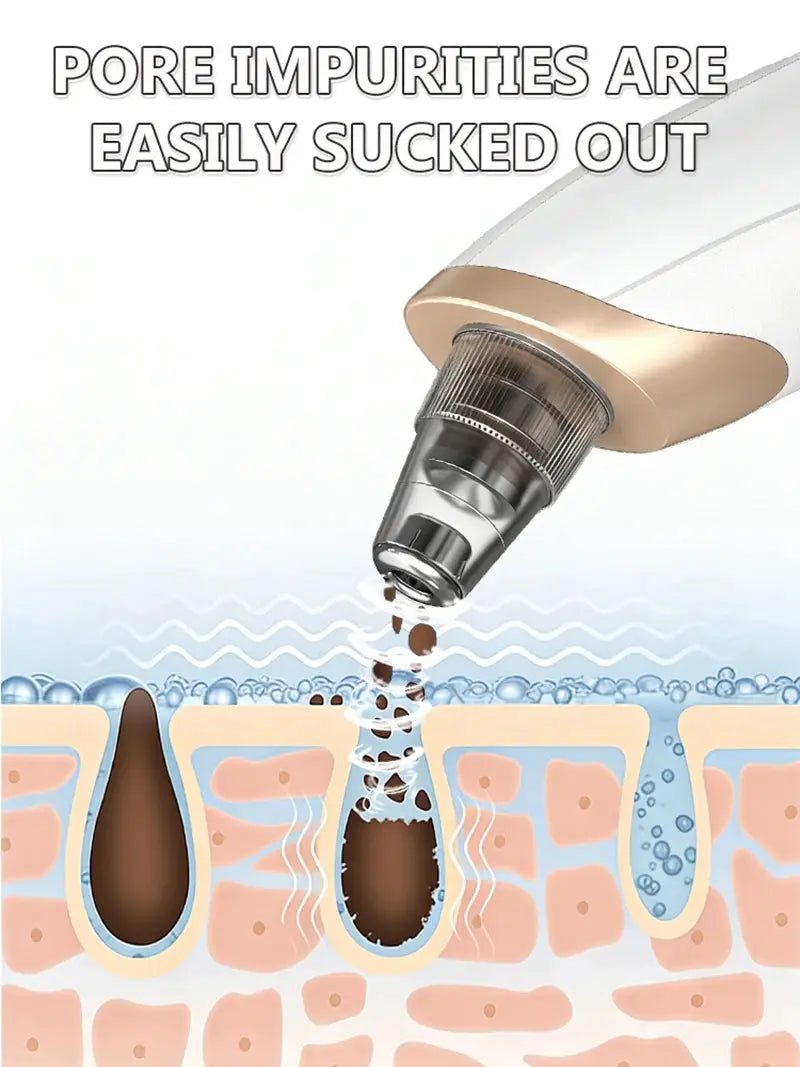Blackhead Remover Pore Cleaner Black Dots Vacuum Cleaner Skin Pimple Acne Extractor Facial Cleaning Electric Black Head Removal from PriceLows™