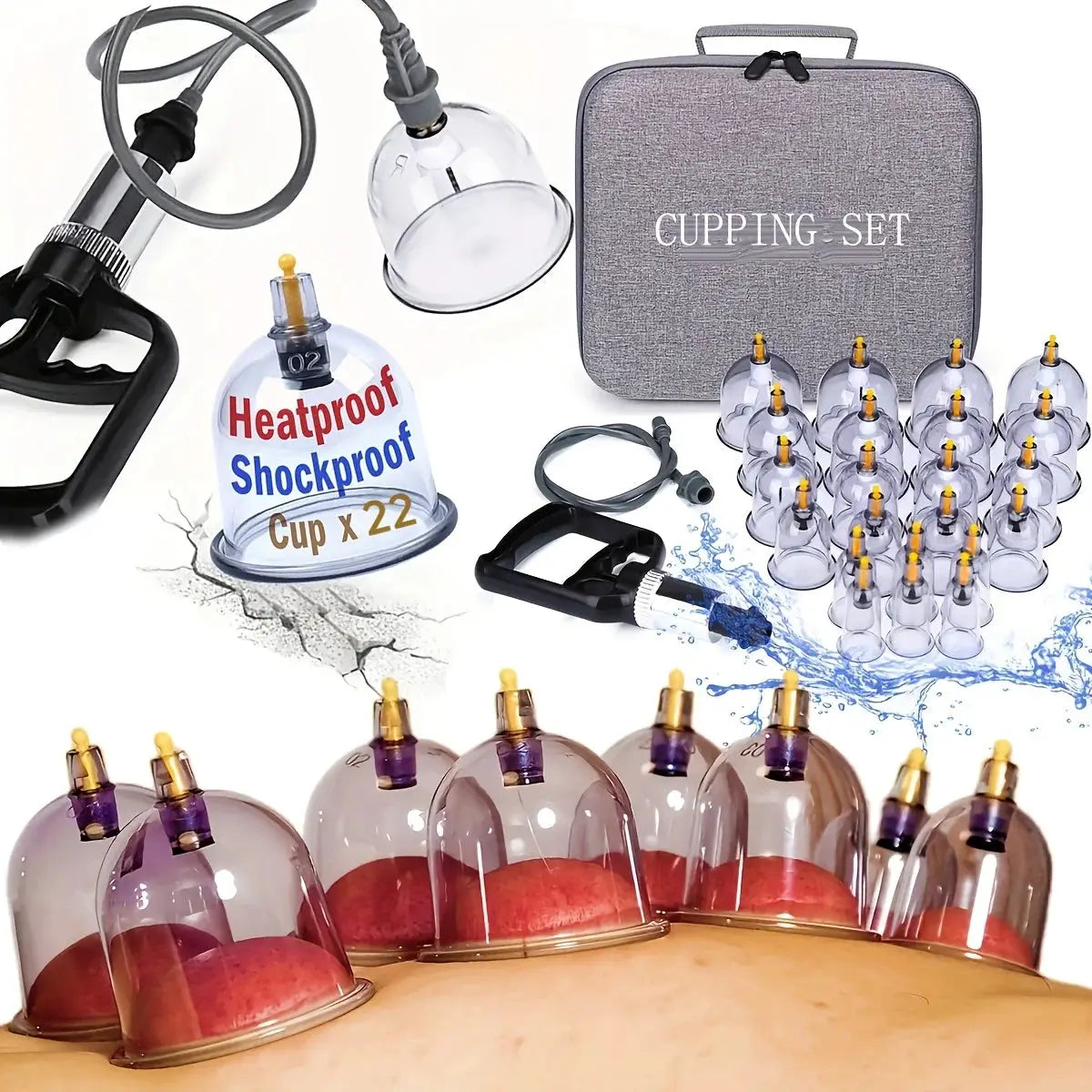 Cupping Set | 22 Pieces | Hand Pump Included | Manual Therapy Kit