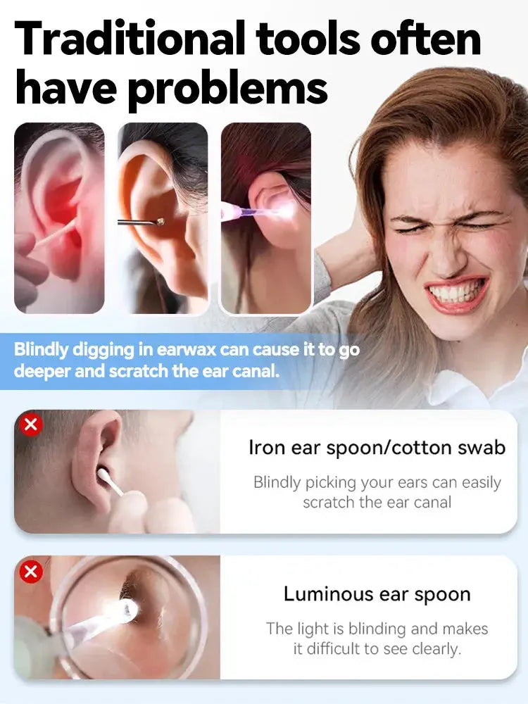 Generation-2,Visual Ear Wax Cleaner Camera Safe Earwax Removal Endoscope Ear Cleaning Tools Ear Care,Black,white styles,Hot sale from PriceLows™