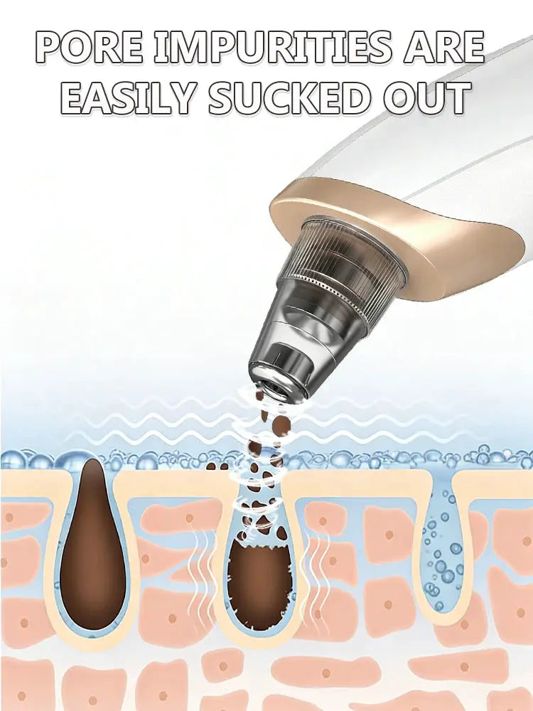 Professional Blackhead Vacuum - Rechargeable Pore Extractor for Blackheads, Oily Skin & Facial Cleansing from PriceLows™
