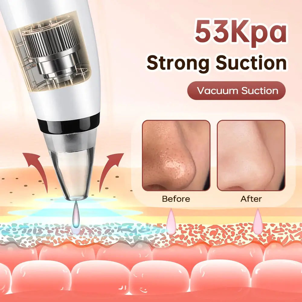 Electric Blackhead Remover Vacuum Acne Cleaner Black Spots Removal Facial Deep Cleansing Pore Cleaner Machine Skin Care Tools from PriceLows™