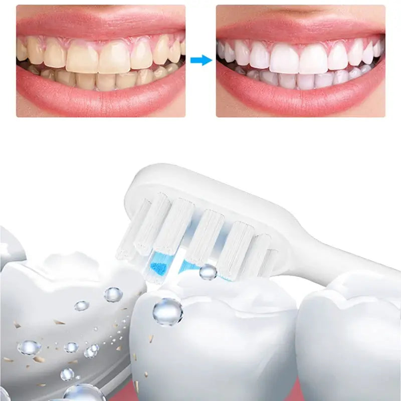 4/8PCS Replacement Brush Heads For XIAOMI MIJIA T700 Sonic Electric Toothbrush Dupont Bristle with Caps Sealed Pack from PriceLows™