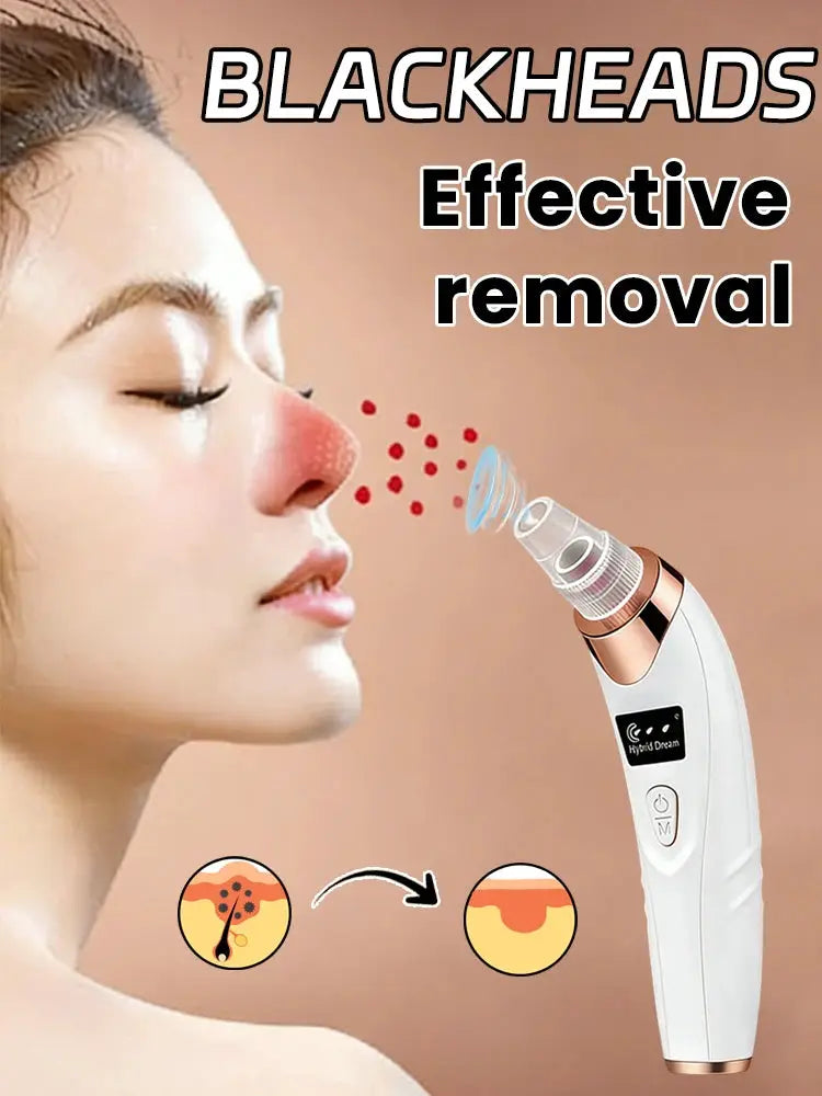Electric Blackhead Remover Vacuum Cleaner Black Dots Vacuum Cleaner Skin Pimple Acne Extractor Facial Cleaning Electric from PriceLows™