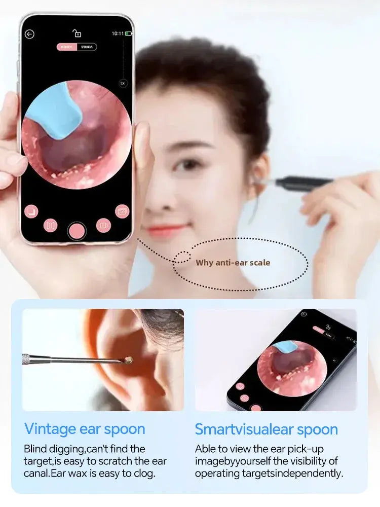 Digital otoscope,Ear Wax Cleaner Camera,endoscope camera,Safe Earwax Removal Endoscope with 15M Camera,Ear Cleaning Tools from PriceLows™