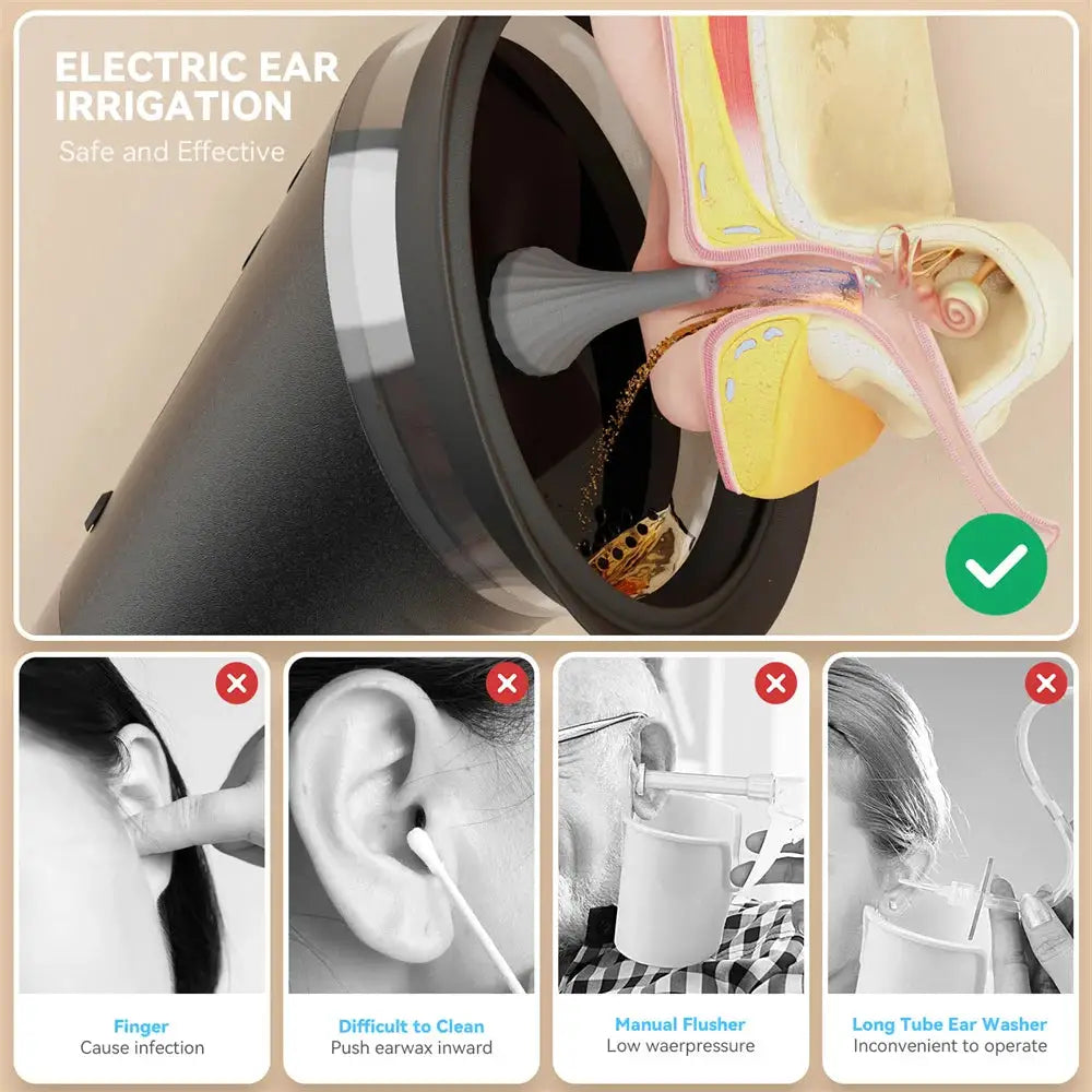 Electric Ear Wax Removal System Water Powered Ear Cleaning Tool with Irrigation Flusher 3 Pressure Settings Safe & Effective from PriceLows™