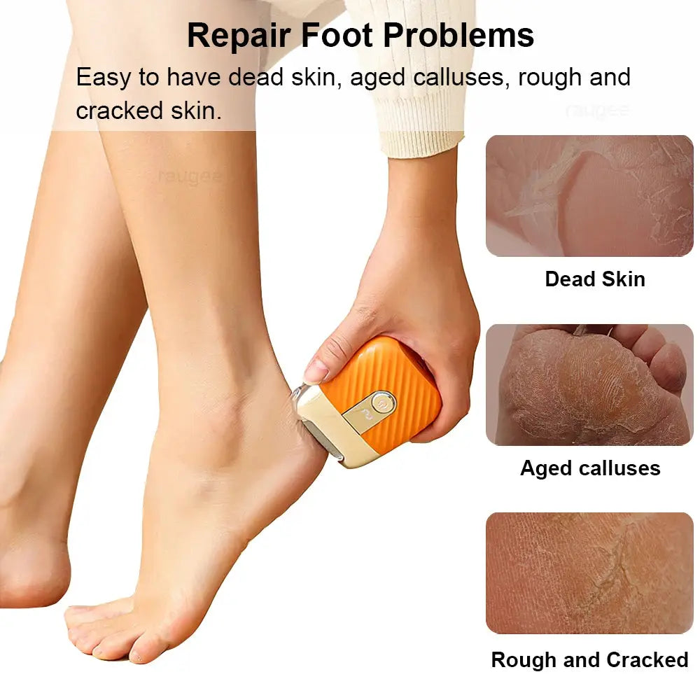 Electric Foot Grinder Rechargeable Automatic Portable Foot Callus Remover Rubbing Pedicure Polishing Hard Dead Skin Removal Tool from PriceLows™