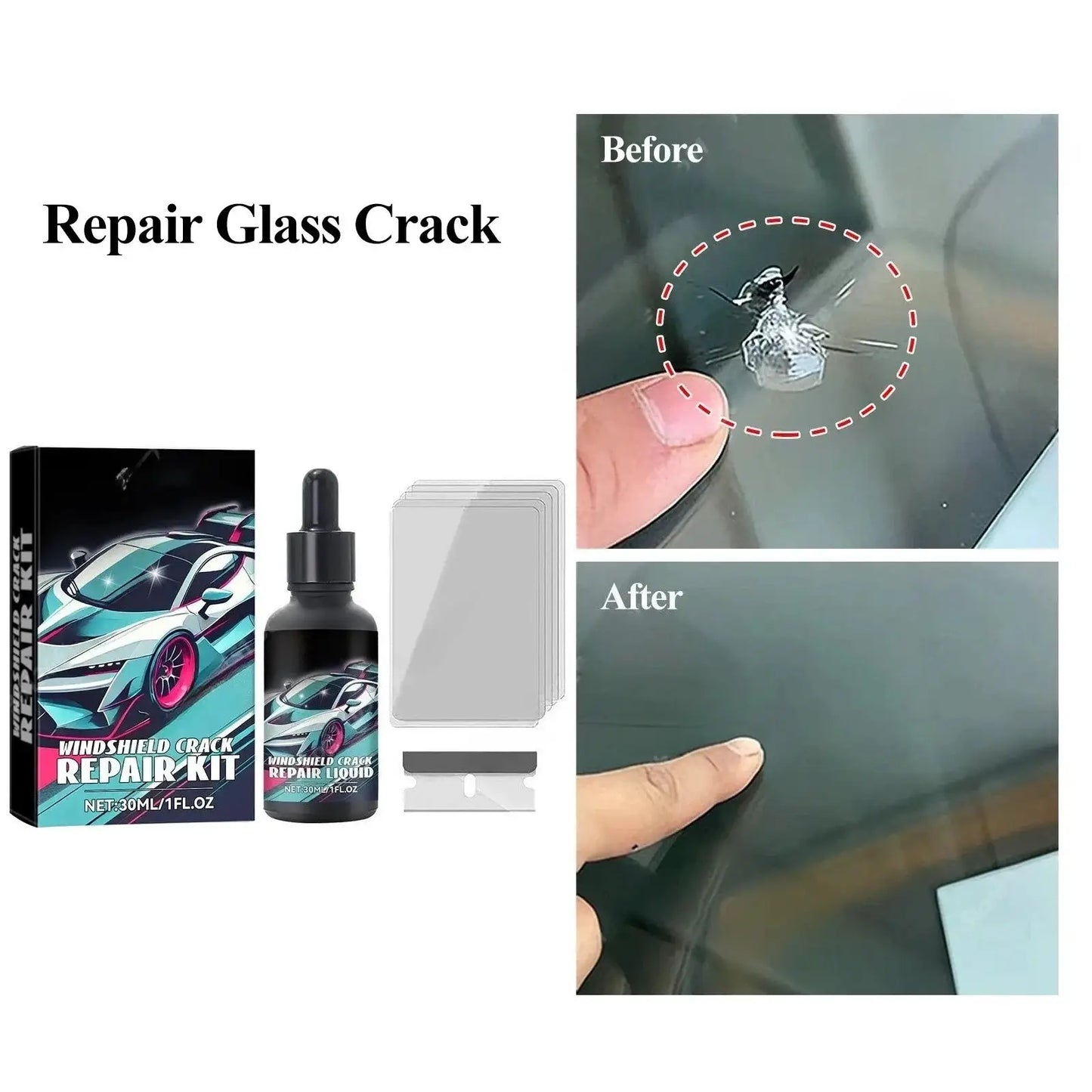 Windscreen Crack Repair Kit | Auto Glass Repair | All Vehicle Types | Universal