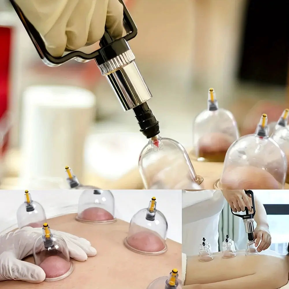 Cupping Set | 22 Pieces | Hand Pump Included | Manual Therapy Kit