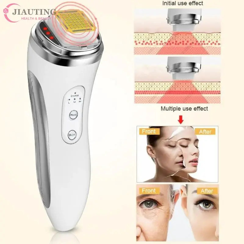 RF Skin Tightening Device | Dot Matrix | Anti Wrinkle | Portable