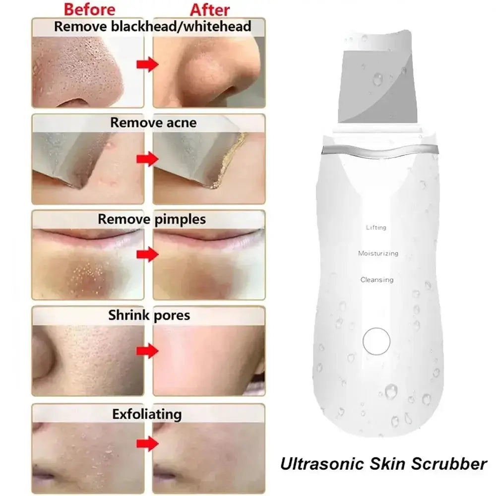 Ultrasonic Skin Scrubber Peeling Blackhead Remover Deep Face Cleaning Acne Pore Cleaner Facial Shovel Cleanser EMS Microcurrent from PriceLows™