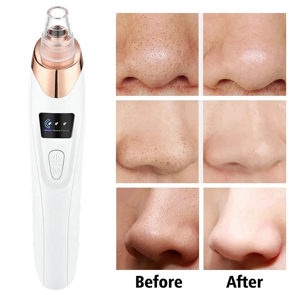 Blackhead Remover Vacuum Pore Adsorber Face Cleaner Electric Pimple Acne Black Head Removal Rechargeable Face Cleaning Tool from PriceLows™