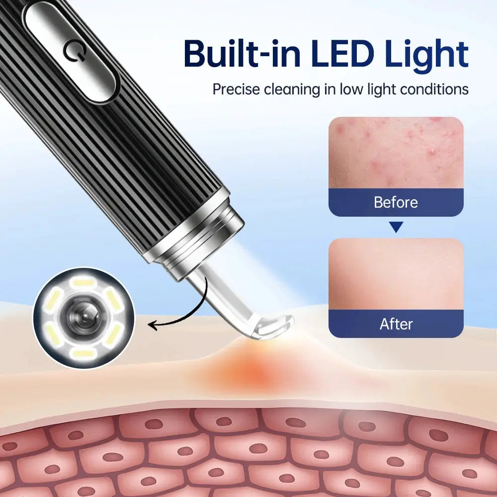 Visual Acne Cleaner 50x HD Camera Blackhead Pimples Remover Machine Electric Pore Cleaning Tools Face Beauty Device Skin Care from PriceLows™