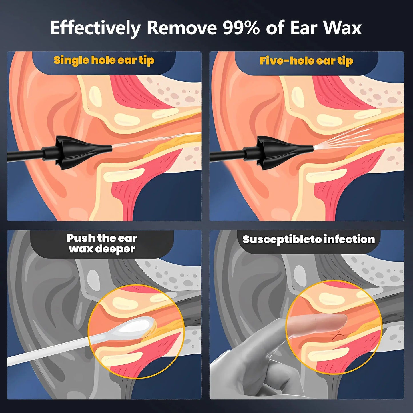 Ear Wax Removal Tool, Electric Ear Irrigation Flushing System, Water Powered with 4 Pressure Modes,8 Reusable Replacement Tips from PriceLows™