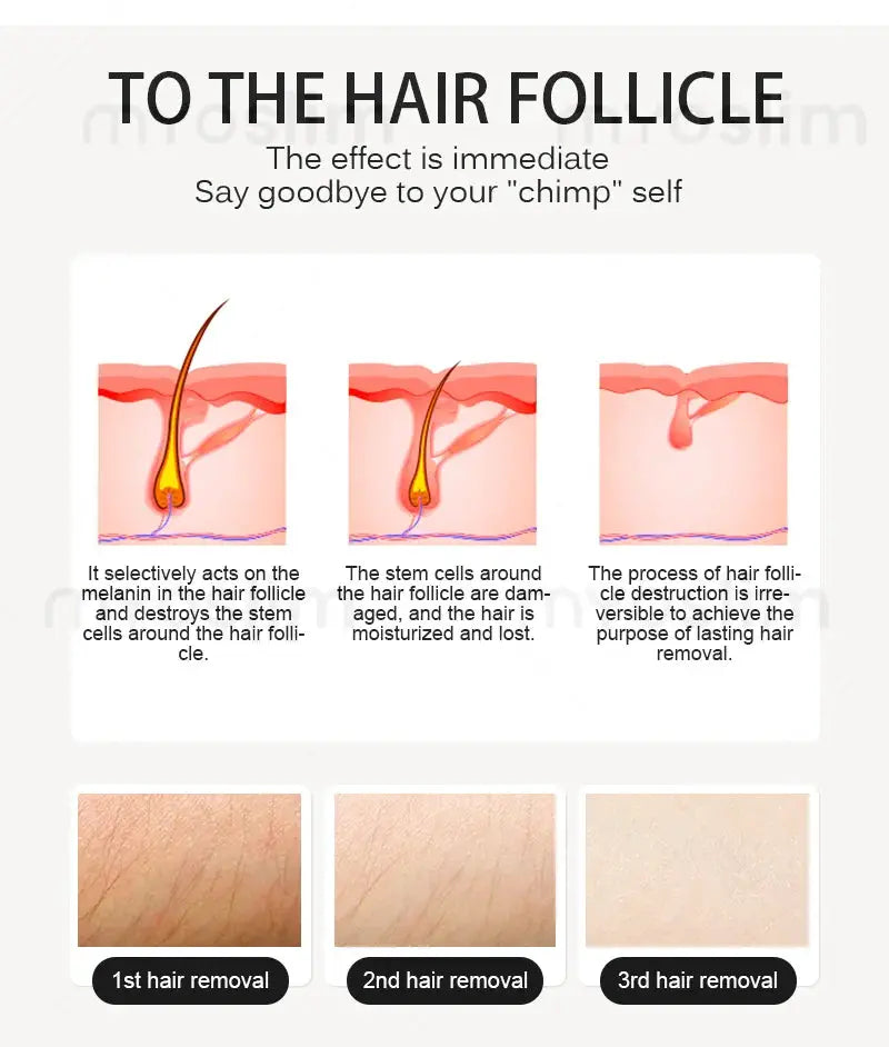 Myoslim Diode Hair Removal Laser | 5000W Power | 808Nm Wavelength | Platinum Ice Cool