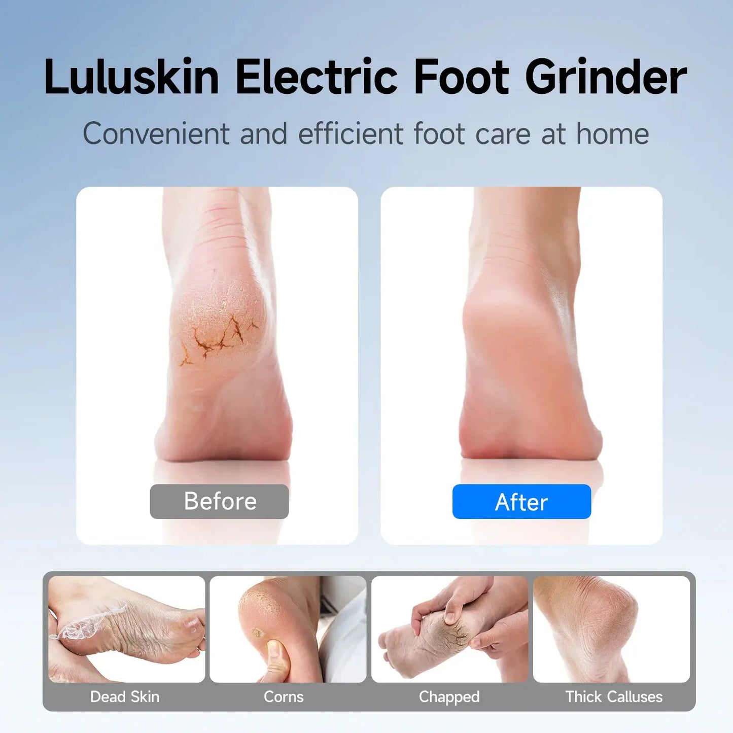 Rechargeable Electric Foot Grinder USB Powered Callus Remover with Adjustable 3 Speeds for Men & Women's Pedicure and Self-Care from PriceLows™