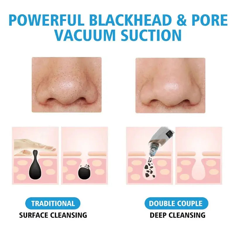 Electric Blackhead Remover Vacuum Acne Cleaner Black Dots Removal Facial Deep Cleansing Pore Cleaner Machine Skin Care Tools from PriceLows™